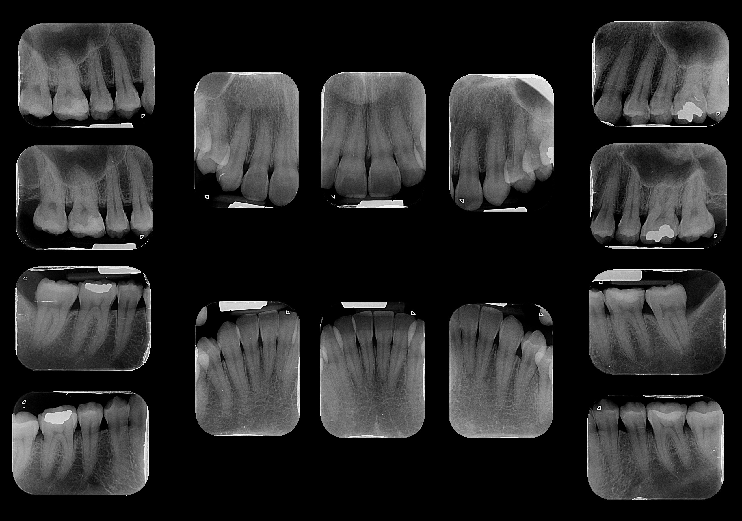 Documentação periodontal: avaliação de osso e gengiva na Aradoc.